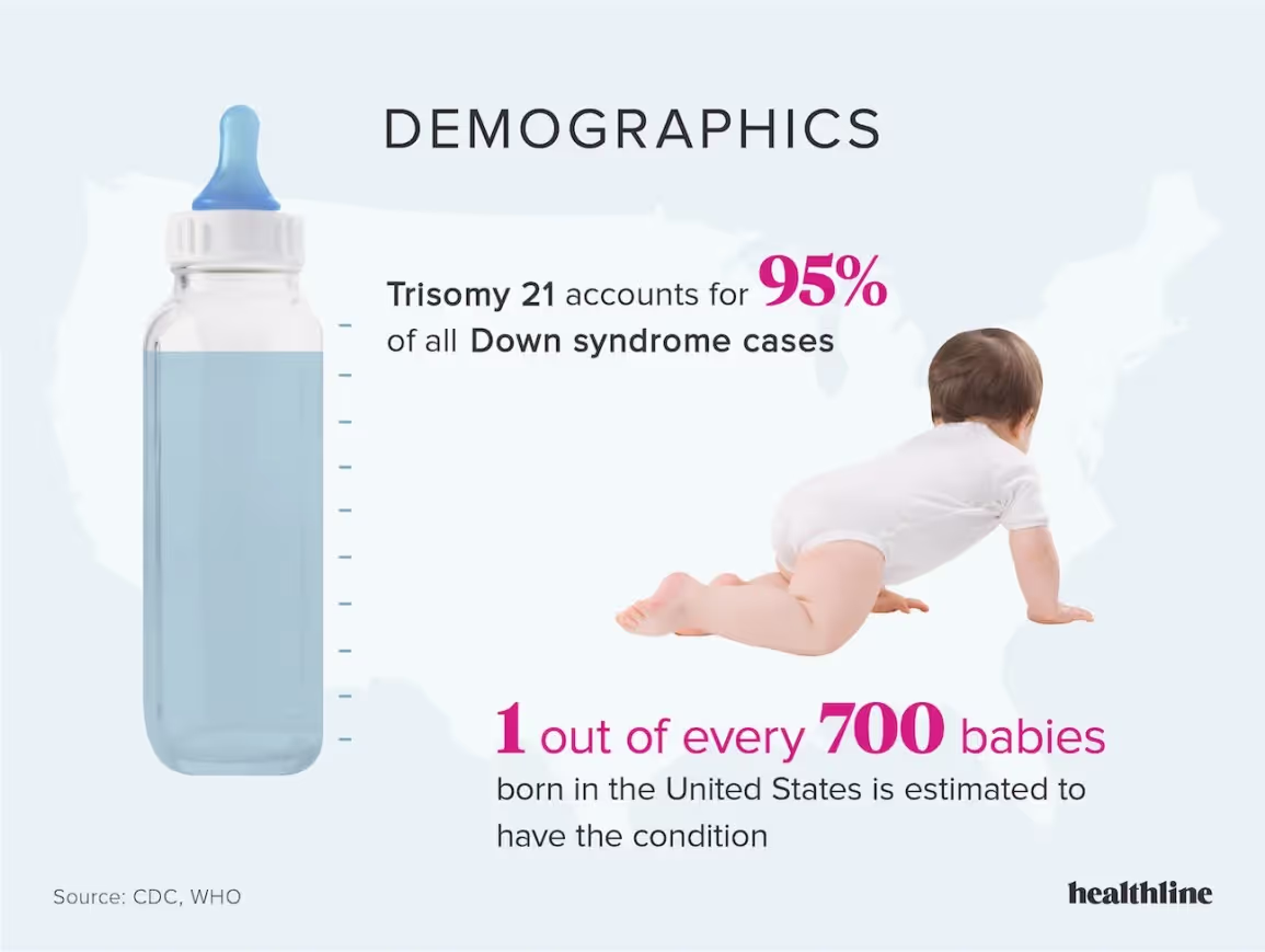 Down Syndrome: Facts, Statistics, and You