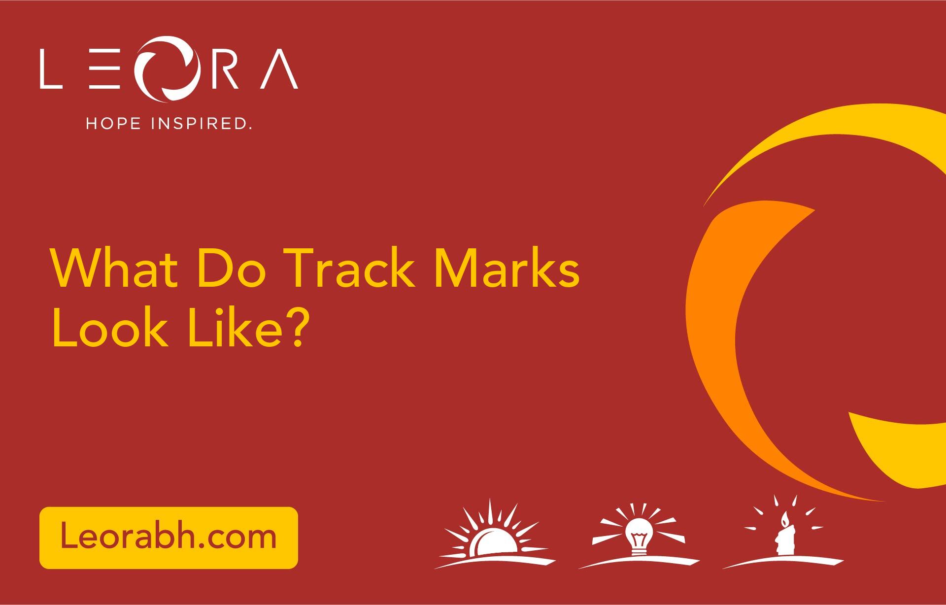 What Do Track Marks Look Like?