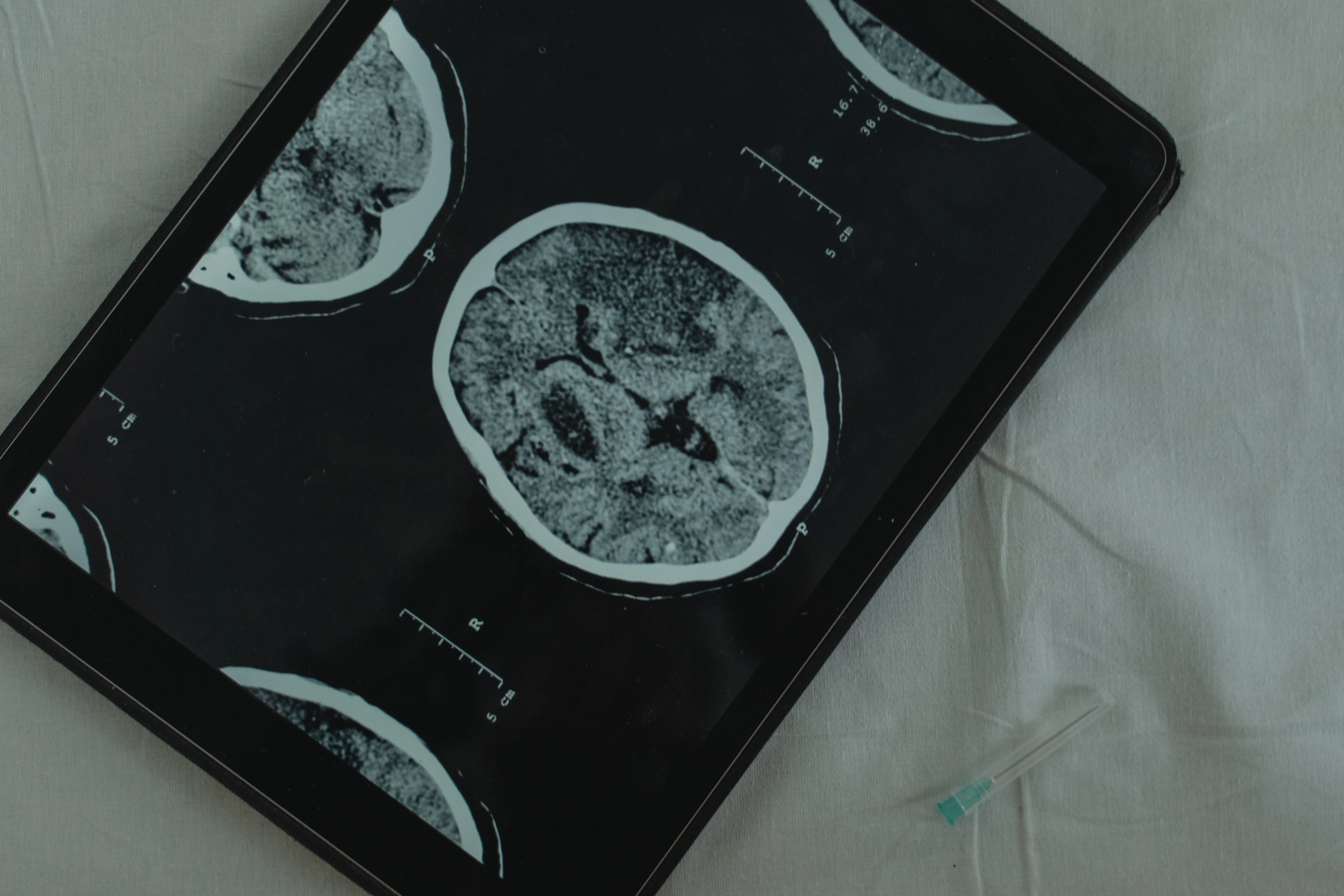 What Are The Four Autism Spectrum Disorders?