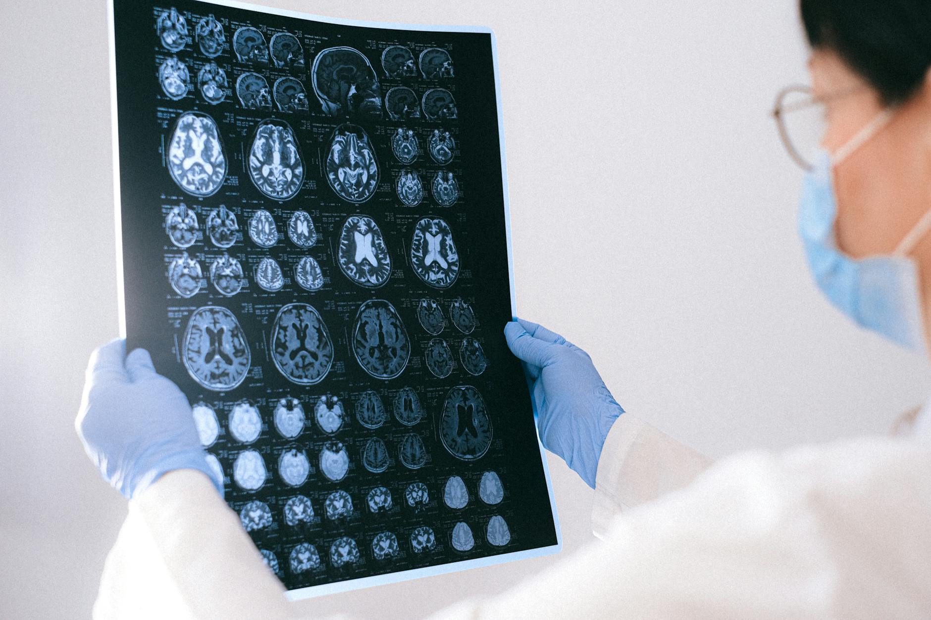 MRI Visibility of Autism Unraveled