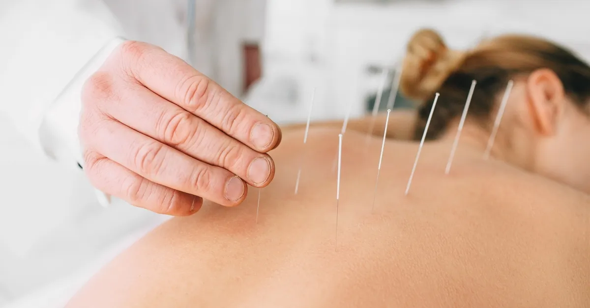 What is Average Cost of Acupuncture Treatments?