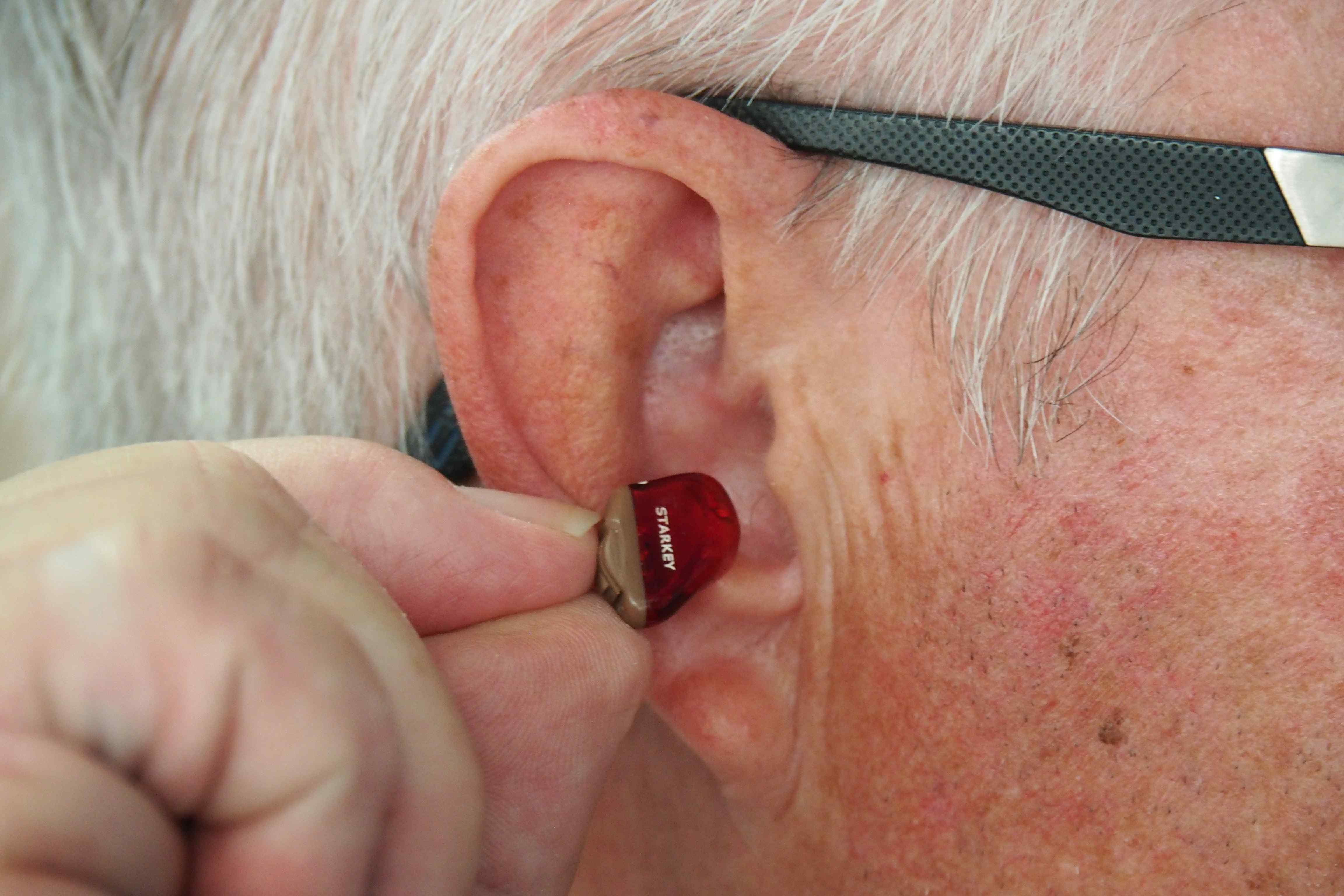 Medicare Hearing Aid Coverage: What You Need to Know