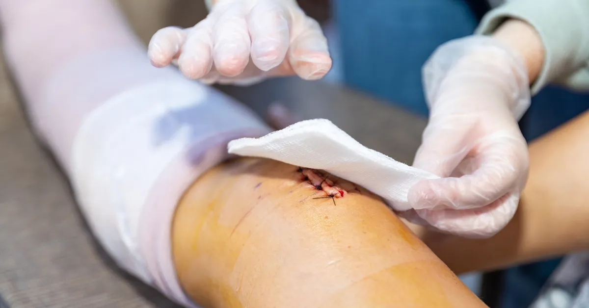 Top 3 Essential Steps for Wound Care for the Elderly