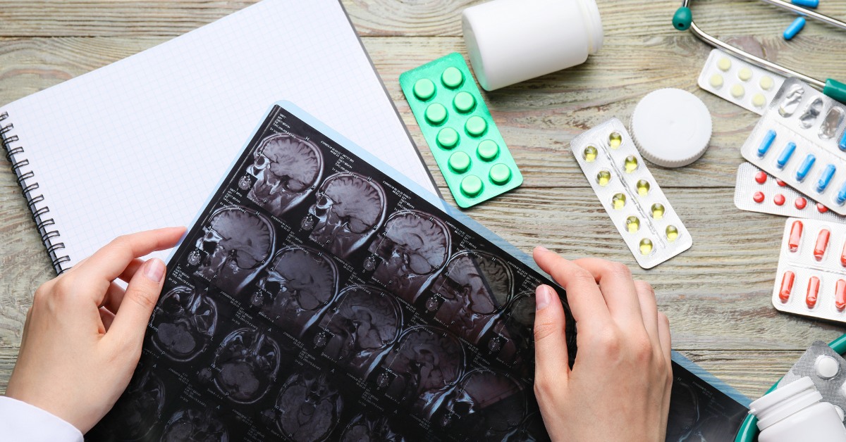 How to Find Neurologist Near You That Take Medicaid?